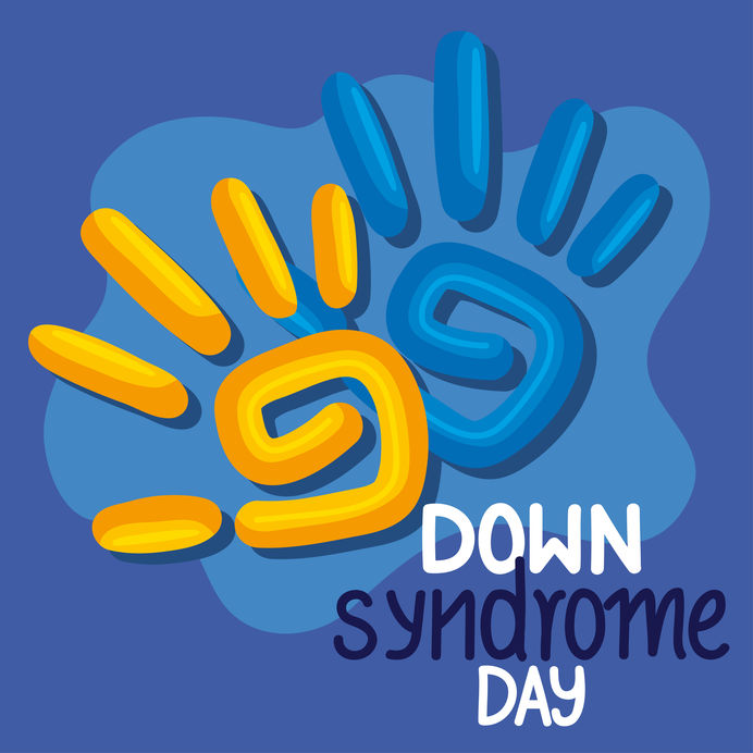 EOC Chairperson calls for supporting people with Down syndrome 